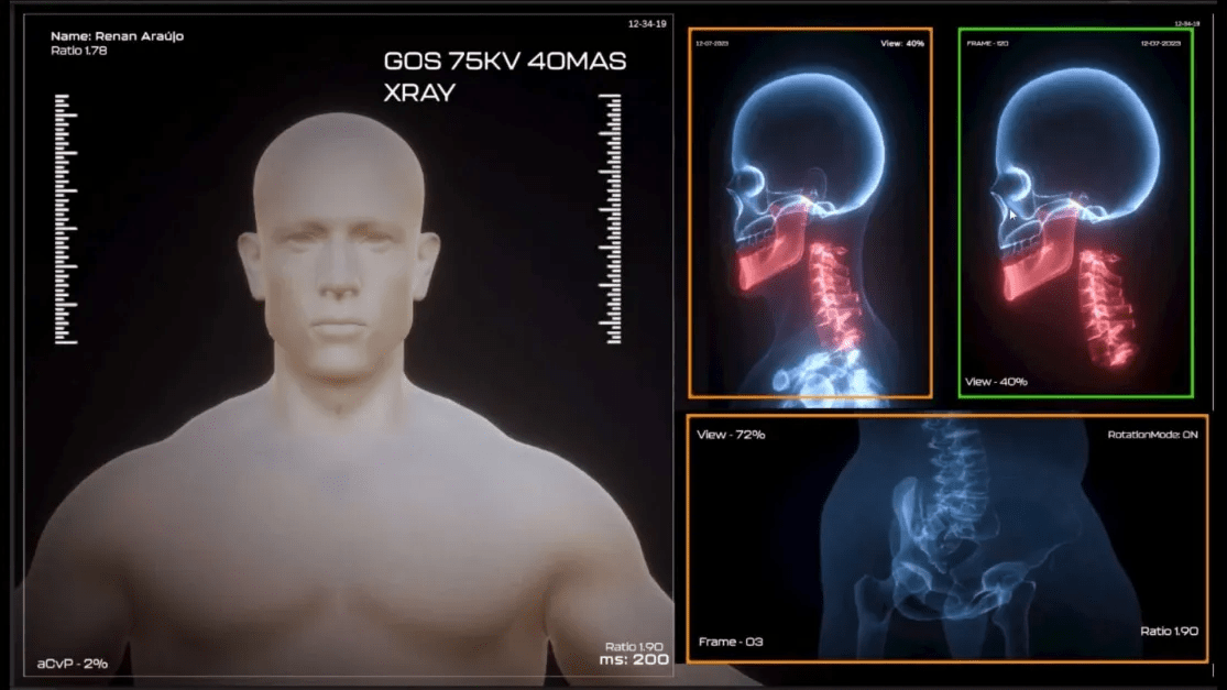 XRay shader Study Case